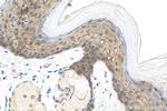 IL-1RA Recombinant Rabbit Monoclonal Antibody (240208G5)