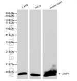 CRIP1 Antibody in Western Blot (WB)