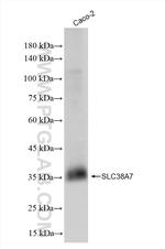 SLC38A7 Antibody in Western Blot (WB)
