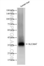 SLC38A7 Antibody in Western Blot (WB)