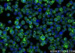 FGR Antibody in Immunocytochemistry (ICC/IF)