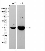 FGR Antibody in Western Blot (WB)