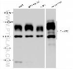 CNKSR2 Antibody in Western Blot (WB)