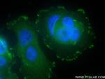 NEDD9 Antibody in Immunocytochemistry (ICC/IF)