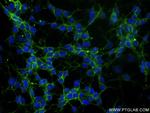 NCAM1/CD56 Antibody in Immunocytochemistry (ICC/IF)