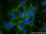 NCAM1/CD56 Antibody in Immunocytochemistry (ICC/IF)