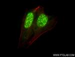 AHR Antibody in Immunocytochemistry (ICC/IF)