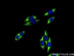 RPL29 Antibody in Immunocytochemistry (ICC/IF)