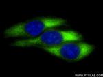 RPL29 Antibody in Immunocytochemistry (ICC/IF)
