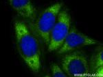 RPL29 Antibody in Immunocytochemistry (ICC/IF)