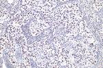 Nucleolin/C23 Antibody in Immunohistochemistry (Paraffin) (IHC (P))