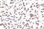 Nucleolin/C23 Antibody in Immunohistochemistry (Paraffin) (IHC (P))