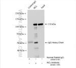Nucleolin/C23 Antibody in Immunoprecipitation (IP)