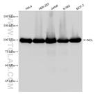 Nucleolin/C23 Antibody in Western Blot (WB)