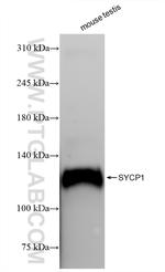 SYCP1 Antibody in Western Blot (WB)