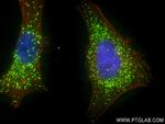 AGXT Antibody in Immunocytochemistry (ICC/IF)