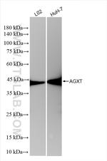 AGXT Antibody in Western Blot (WB)