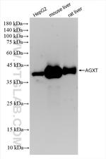 AGXT Antibody in Western Blot (WB)