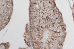 SIAH1 Antibody in Immunohistochemistry (Paraffin) (IHC (P))