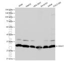 SIAH1 Antibody in Western Blot (WB)