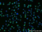 Fas/CD95 Antibody in Immunocytochemistry (ICC/IF)