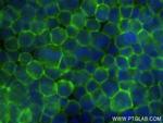 Fas/CD95 Antibody in Immunocytochemistry (ICC/IF)