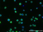 Fas/CD95 Antibody in Immunocytochemistry (ICC/IF)