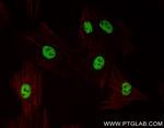 TBX20 Antibody in Immunocytochemistry (ICC/IF)