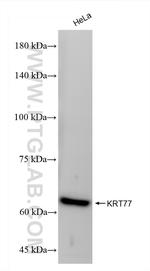 Keratin 77 Antibody in Western Blot (WB)
