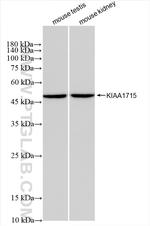 KIAA1715 Antibody in Western Blot (WB)