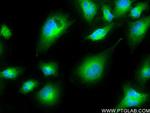 KIAA1715 Antibody in Immunocytochemistry (ICC/IF)
