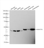 KIAA1715 Antibody in Western Blot (WB)