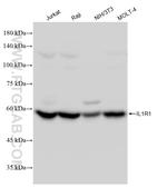 IL1R1 Antibody in Western Blot (WB)