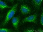 Ferritin heavy chain Antibody in Immunocytochemistry (ICC/IF)
