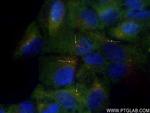 PLK2 Antibody in Immunocytochemistry (ICC/IF)