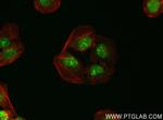 THOC5 Antibody in Immunocytochemistry (ICC/IF)