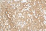CD200 Antibody in Immunohistochemistry (Paraffin) (IHC (P))