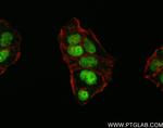 PMS1 Antibody in Immunocytochemistry (ICC/IF)