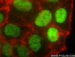 PMS1 Antibody in Immunocytochemistry (ICC/IF)