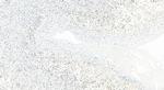 PMS1 Antibody in Immunohistochemistry (Paraffin) (IHC (P))