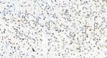 PMS1 Antibody in Immunohistochemistry (Paraffin) (IHC (P))