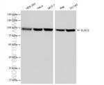 ELAC2 Antibody in Western Blot (WB)