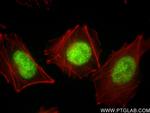 FOXC2 Antibody in Immunocytochemistry (ICC/IF)