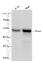 TRIM22 Antibody in Western Blot (WB)