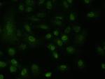MAGEA3 Antibody in Immunocytochemistry (ICC/IF)