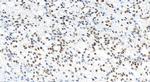 RPP30 Antibody in Immunohistochemistry (Paraffin) (IHC (P))