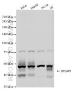 STEAP3 Antibody in Western Blot (WB)