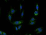HTRA2 Antibody in Immunocytochemistry (ICC/IF)