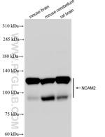 NCAM2 Antibody in Western Blot (WB)