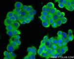 HARS Antibody in Immunocytochemistry (ICC/IF)